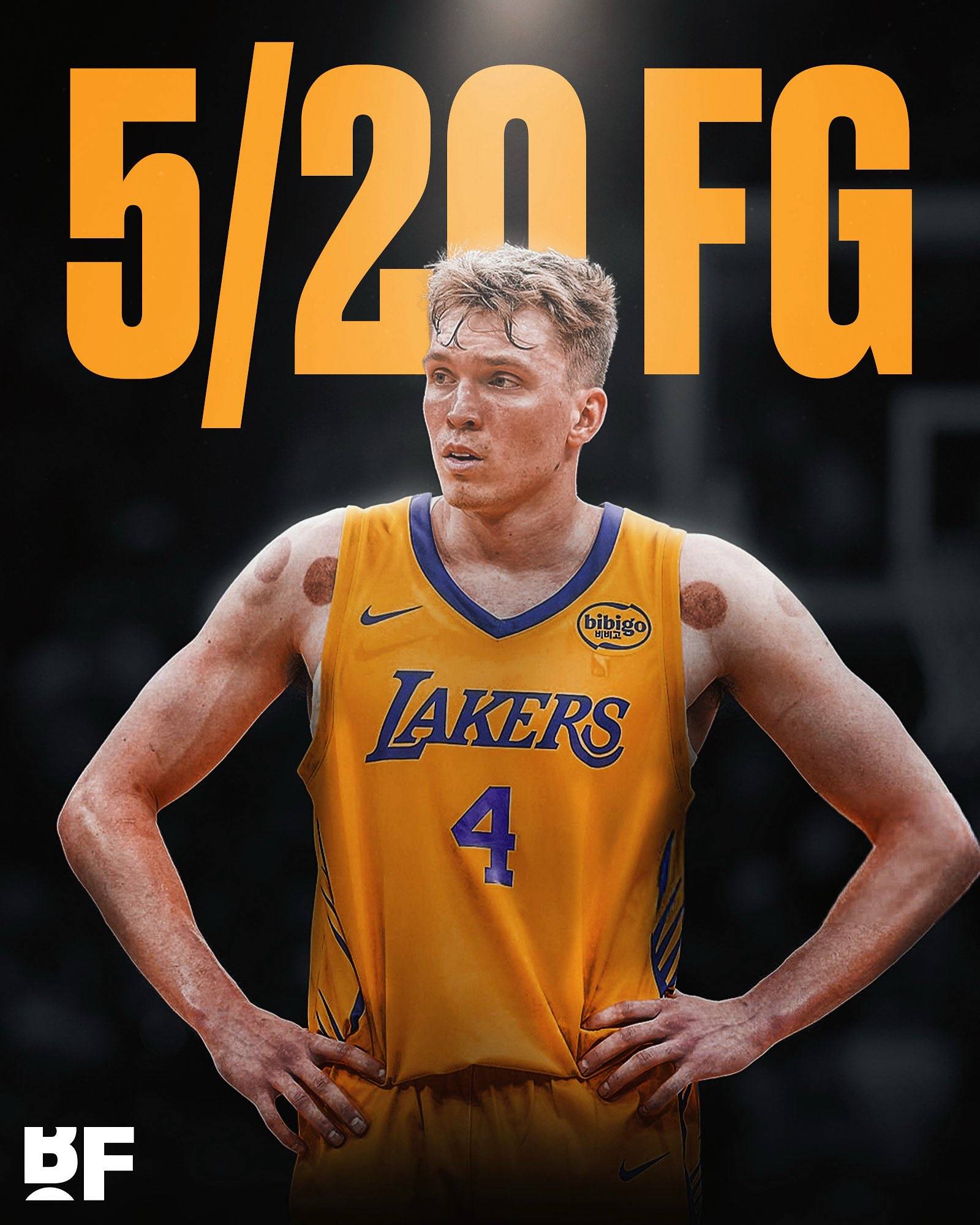 开云APP下载-转会期洛杉矶湖人再遭质疑——意甲节点到来，球迷炸锅，训练强度明显提升的简单介绍